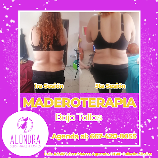 Maderoterapia baja tallas antes y despues 1ra a 5ta sesion